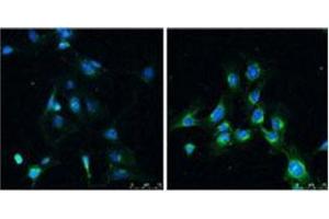Immunofluorescence analysis of LC3B Antibody  in Rat brain before (left) and after (right) treatment with rapamycin (100 nm for 4 hr).