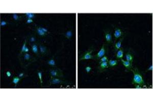 Immunofluorescence analysis of LC3B Antibody  in Rat brain before (left) and after (right) treatment with rapamycin (100 nm for 4 hr). (LC3B anticorps  (N-Term))