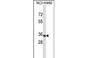 OR14C36 Antibody (C-term) (ABIN657683 and ABIN2846675) western blot analysis in NCI- cell line lysates (35 μg/lane). (OR14C36 anticorps  (C-Term))