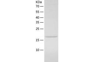 Western Blotting (WB) image for Prospero Homeobox 1 (PROX1) (AA 547-737) protein (His tag) (ABIN7124605)