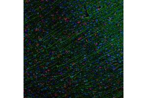 Image no. 3 for anti-Chemokine (C-C Motif) Ligand 5 (CCL5) antibody (ABIN465753) (CCL5 anticorps)