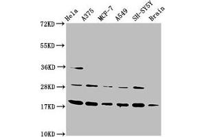 Western Blot Positive WB detected in: Hela whole cell lysate, A375 whole cell lysate, MCF-7 whole cell lysate, A549 whole cell lysate, SH-SY5Y whole cell lysate, Rat brain tissue All lanes: DAZAP2 antibody at 3. (DAZAP2 anticorps  (AA 1-168))