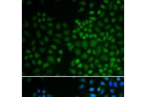 Immunofluorescence analysis of U2OS cells using NR0B2 Polyclonal Antibody (NR0B2 anticorps)