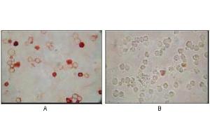 Immunocytochemistry analysis of TPA induced BCBL-1 cells (A) and uninduced BCBL-1 cells (B) using KSHV ORF62 mouse mAb with AEC staining. (KSHVORF62 anticorps)