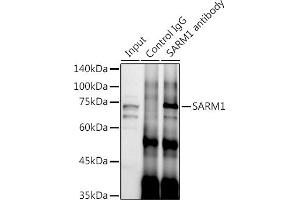 Immunoprecipitation analysis of 300 μg extracts of SH-SY5Y cells using 3 μg S antibody (ABIN7270591). (SARM1 anticorps)