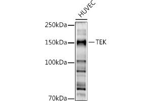 Western blot analysis of extracts of HUVEC cells, using TEK antibody (ABIN6127575, ABIN6148992, ABIN6148994 and ABIN6213973) at 1:500 dilution. (TEK anticorps  (AA 500-750))