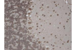 Immunohistochemistry analysis using Mouse Anti-TrpM7 Monoclonal Antibody, Clone S74 (ABIN361775).