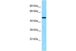 WB Suggested Anti-CLNK Antibody Titration: 1. (CLNK anticorps  (C-Term))