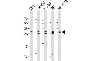 All lanes : Anti-EIF4E2 Antibody at 1:2000 dilution Lane 1: 293 whole cell lysate Lane 2: HepG2 whole cell lysate Lane 3: HL-60 whole cell lysate Lane 4: RD whole cell lysate Lane 5: NIH/3T3 whole cell lysate Lysates/proteins at 20 μg per lane. (EIF4E2 anticorps)