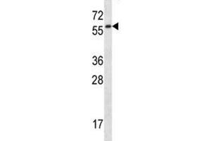 Fyn antibody western blot analysis in mouse lung tissue lysate.
