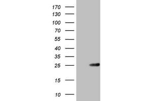 Western Blotting (WB) image for anti-ATP-Binding Cassette, Sub-Family C (CFTR/MRP), Member 5 (ABCC5) antibody (ABIN2715613) (ABCC5 anticorps)