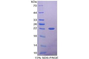 SDS-PAGE of Protein Standard from the Kit (Highly purified E. (AMBP Kit ELISA)