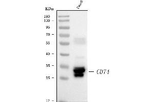 Western blot analysis of CD74 using anti-CD74 antibody (ABIN7602385). (CD74 anticorps  (AA 73-296))