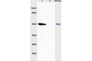 Lane 1: mouse brain lysates Lane 2: mouse lung lysates probed with Anti Caspase-9 p10 Polyclonal Antibody, Unconjugated (ABIN1387603) at 1:200 in 4 °C.