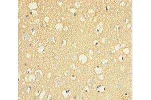 Immunohistochemistry of paraffin-embedded human brain tissue using ABIN7174125 at dilution of 1:100 (SIRPA anticorps  (AA 31-373))