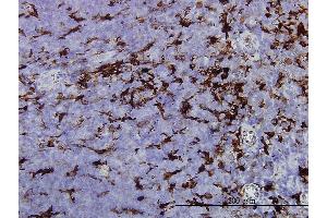 Immunoperoxidase of monoclonal antibody to GSN on formalin-fixed paraffin-embedded human tonsil.