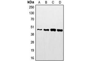 Western blot analysis of STAC2 expression in HeLa (A), mouse kidney (B), rat kidney (C), A431 (D) whole cell lysates. (STAC2 anticorps  (Center))