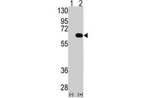 Western blot analysis of AMFR (arrow) using AMFR polyclonal antibody . (AMFR anticorps  (AA 571-601))