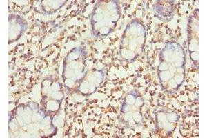 Immunohistochemistry of paraffin-embedded human small intestine tissue using ABIN7154604 at dilution of 1:100