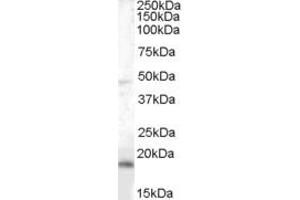 Western Blotting (WB) image for anti-Brain and Acute Leukemia, Cytoplasmic (BAALC) (AA 136-150) antibody (ABIN296188) (BAALC anticorps  (AA 136-150))
