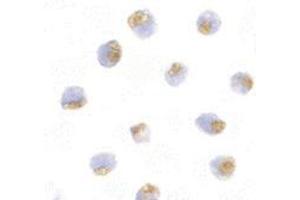 Immunocytochemistry of TLR1 in Daudi with this product at 10 μg/ml. (TLR1 anticorps  (Center))