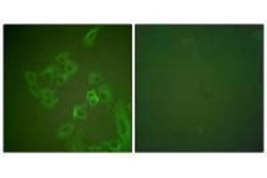 Immunofluorescence analysis of A549 cells, using Synuclein β antibody. (beta Synuclein anticorps)