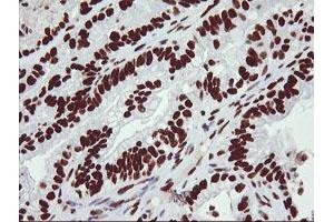 Image no. 6 for anti-Non-POU Domain Containing, Octamer-Binding (NONO) (AA 184-385) antibody (ABIN1491072) (NONO anticorps  (AA 184-385))