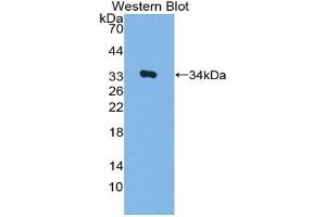 Western blot analysis of the recombinant protein. (MYB anticorps  (AA 35-291))