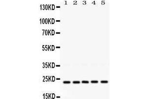 Western Blotting (WB) image for anti-RAB18, Member RAS Oncogene Family (RAB18) (AA 156-192), (C-Term) antibody (ABIN3043365)
