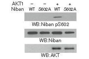 Western blot analysis in vitro kinase assays were performed by mixing purified bacterially expressed WT His-Niban or the His-Niban S602A with or without purified active AKT1 using Niban (Phospho-Ser602) Antibody. (Niban anticorps  (pSer602))