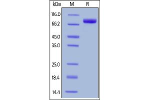 Cynomolgus SIRP alpha, Fc Tag on  under reducing (R) condition.