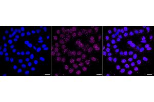 Immunocytochemical staining of HepG2 cells with Histone H2B (crotonyl K12) antibody (ABIN7798945), 1:1,000).