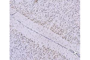 IHC analysis of FOXK1 using anti-FOXK1 antibody (ABIN7600295). (Foxk1 anticorps  (AA 175-671))