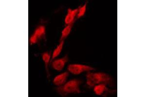 ABIN6266703 staining HeLa by IF/ICC. (PHF1 anticorps  (Internal Region))