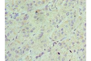 Immunohistochemistry of paraffin-embedded human liver tissue using ABIN7143342 at dilution of 1:100