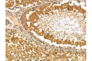 ABIN6259183 and ABIN6275173 at 1/100 staining Rat testis tissue by IHC-P. (SAR1B anticorps  (Internal Region))