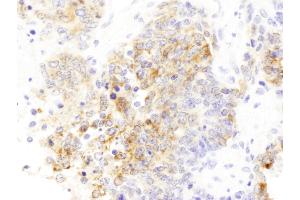 Immunohistochemistry (IHC) image for anti-Drebrin 1 (DBN1) (AA 599-649) antibody (ABIN7453432) (DBN1 anticorps  (AA 599-649))