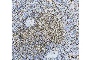 IHC analysis of Exonuclease 1/EXO1 using anti-Exonuclease 1/EXO1 antibody (ABIN7599229).