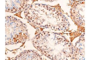 ABIN6267073 at 1/100 staining mouse testicular tissue sections by IHC-P. (CHEK1 anticorps  (pSer280))