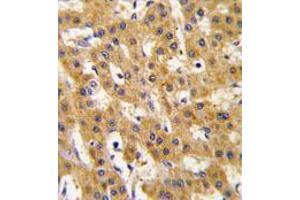 Image no. 3 for anti-Pyruvate Dehydrogenase Complex, Component X (PDHX) antibody (ABIN357415) (PDHX anticorps)