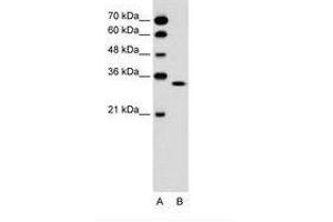 Image no. 1 for anti-Olfactory Receptor, Family 5, Subfamily T, Member 2 (OR5T2) (C-Term) antibody (ABIN6736622) (OR5T2 anticorps  (C-Term))