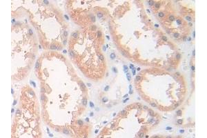 Detection of DSC1 in Human Kidney Tissue using Polyclonal Antibody to Desmocollin 1 (DSC1)