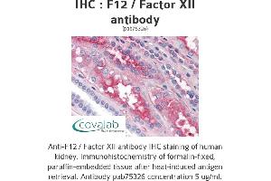Image no. 1 for anti-Coagulation Factor XII (F12) antibody (ABIN1734212)