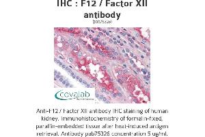 Image no. 1 for anti-Coagulation Factor XII (F12) antibody (ABIN1734212) (F12 anticorps)