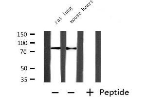 Western blot analysis of extracts from mouse heart and rat lung, using PRMT7 Antibody. (PRMT7 anticorps  (Internal Region))