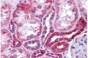 Human Kidney: Formalin-Fixed, Paraffin-Embedded (FFPE)