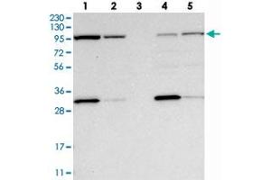 Western blot analysis of Lane 1: RT-4, Lane 2: U-251 MG, Lane 3: Human Plasma, Lane 4: Liver, Lane 5: Tonsil with EXOC2 polyclonal antibody  at 1:250-1:500 dilution. (EXOC2 anticorps)