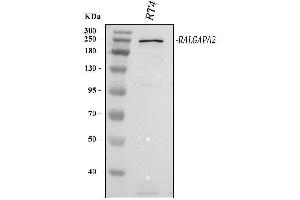 Western blot analysis of C20orf74/RALGAPA2 using anti-C20orf74/RALGAPA2 antibody (ABIN7600871).