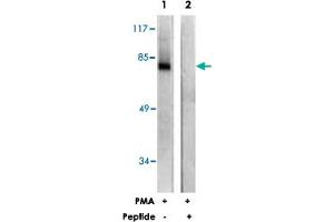 Western blot analysis of extracts from COS-7 cells, treated with PMA (125 ng/mL, 30 mins), using PRKCZ polyclonal antibody . (PKC zeta anticorps)
