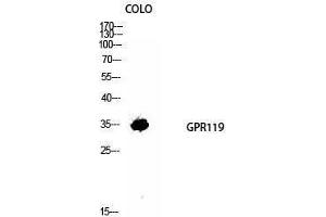Western Blotting (WB) image for anti-G Protein-Coupled Receptor 119 (GPR119) (Internal Region) antibody (ABIN3184842) (G Protein-Coupled Receptor 119 anticorps  (Internal Region))